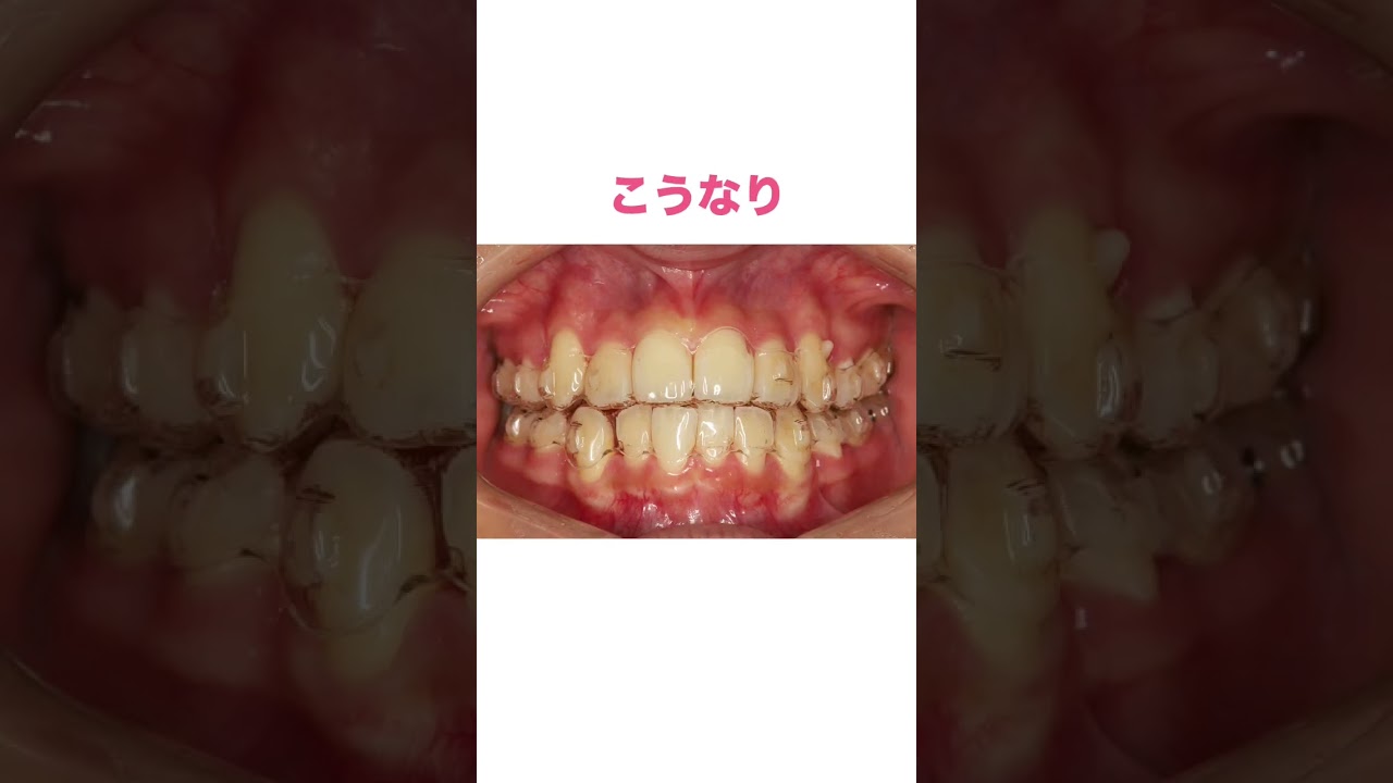 1760971268_maxresdefault-6351386-2558039-jpg